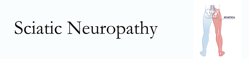 Groton neuropathy pain (sciatica) 